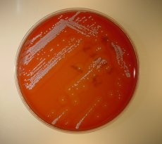 Selective isolation media of Staphylococcus