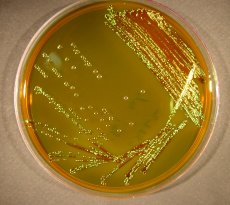 Mycobacterium