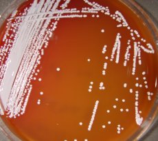 Anaerob bacteria