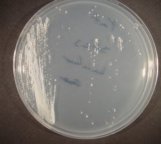 Fungal contamination of alim.prod.
