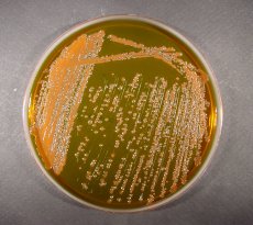 Detection of Coliforms 
