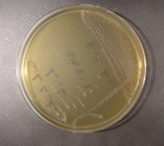 Detection of Enterococcus spp.