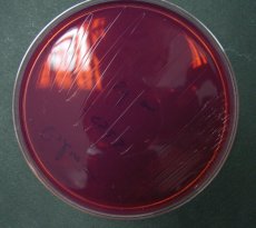 Detection of Listeria spp.