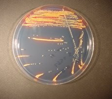 Selective media for pathogens of urinary tract infections