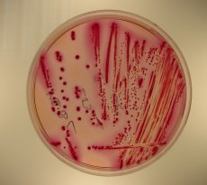Culture of Clostridium perf.