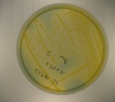 Culture of Bacteroides spp.