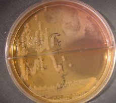 Isolation of yeasts and moulds 