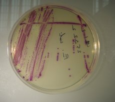 Chromogenic Uricolor agar 