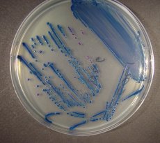 Chromogenic Coliform E-coli Agar